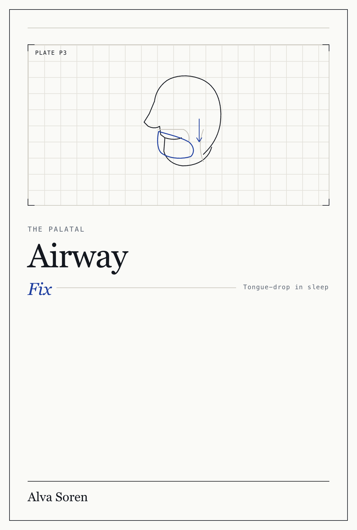 The Palatal Airway Fix