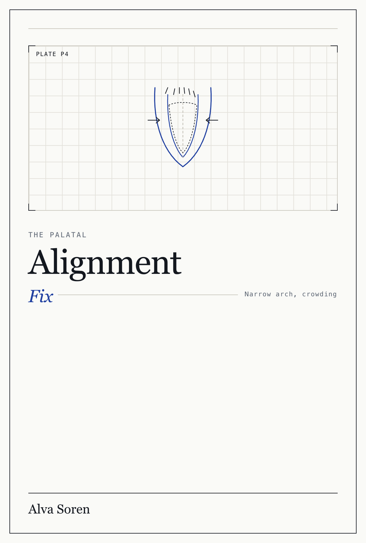 The Palatal Alignment Fix