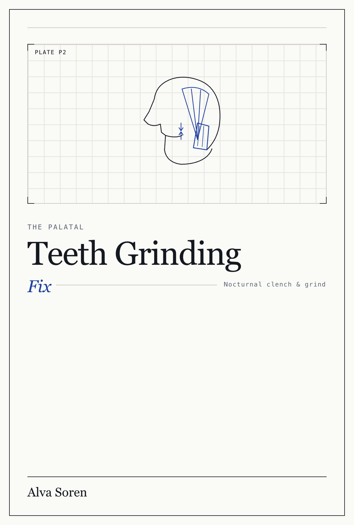 The Palatal Teeth Grinding Fix