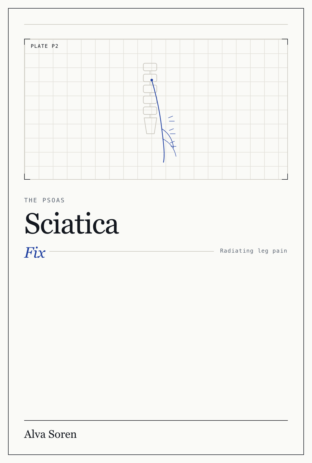 The Psoas Sciatica Fix
